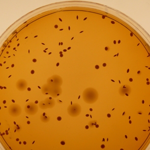 Lactobacillus salivarius. лактобактерии среды. лактобактерии l acidophilus. микробиом влагалища лактобактерии. Lactobacillus plantarum на агаре.